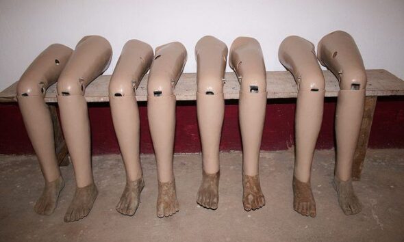 CAF Reveal The Bizarre Items Donated To Charity